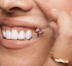 Curaprox Interdentalbürste bei der Anwendung