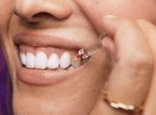 Curaprox Interdentalbürste bei der Anwendung